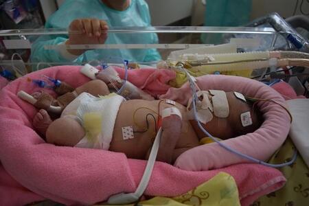 不妊治療6年、40代で授かった娘は「運動に障害が出るかも」　ところが……“奇跡の成長”に感動の声