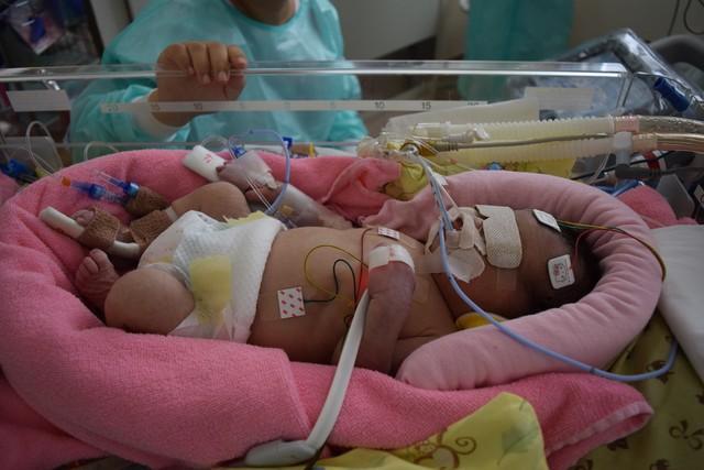 生後1日目（低体温療法中）「麻痺や障害が出る可能性がある」と宣告された娘／ミコフォトさん（@mi.ko.photo）提供