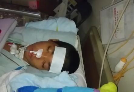 深い意識障害の状態となり、気管切開後の樹希さん。搬送時、顔は本来の形が分からないほど腫れ上がっていた