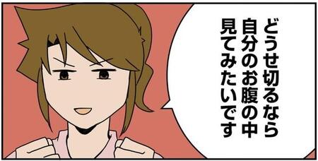 近づく帝王切開　看護師「何かご希望は？」私「どうせ切るなら腹の中を見たいです」産科麻酔の教授「いいよー」【漫画】