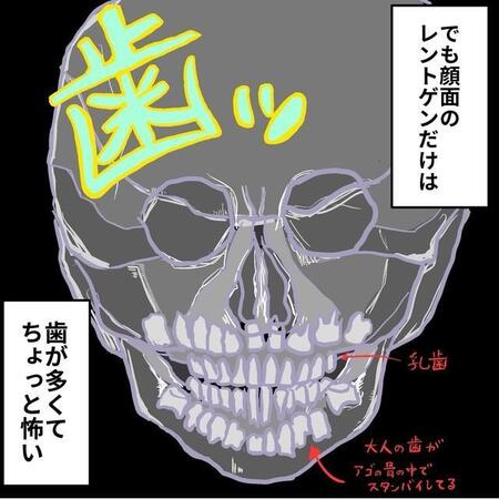 乳歯と永久歯で歯がいっぱい（からばく社さん提供）