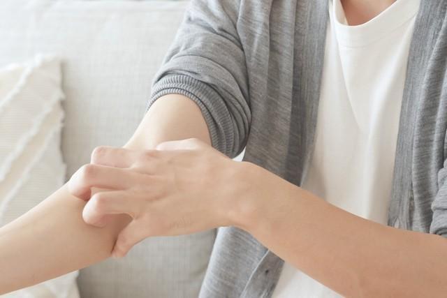 アトピー性皮膚炎患者の8割以上「仕事のストレスによる症状が悪化した」　※画像はイメージです（polkadot/stock.adobe.com）