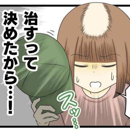 抜毛症を治したい！（春乃おはなさん提供）