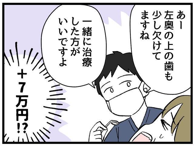 歯の自由診療、費用がバカになりませんよね