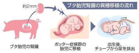 　ブタ胎児腎臓の異種移植の流れ