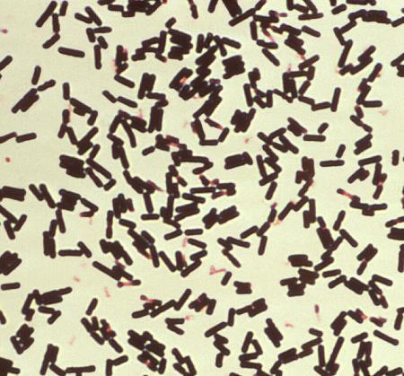 　ウエルシュ菌の顕微鏡写真（米疾病対策センター提供）