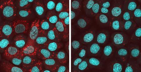 ＡＬＳ、化合物で制御期待　治験へ製薬会社募る、奈良