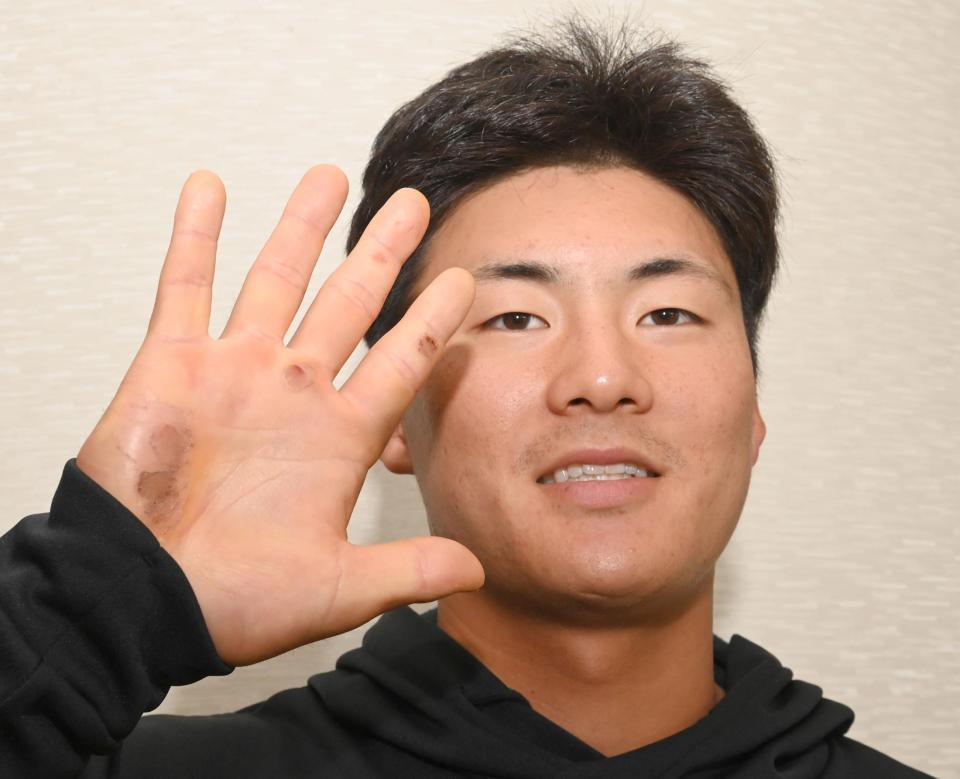 　充実のキャンプを送る前川。バットを振りこみ、マメができた手を見せてくれた（撮影・飯室逸平）