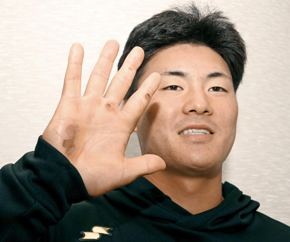 充実のキャンプを送る前川。バットを振りこみ、マメができた手を見せてくれた（撮影・飯室逸平）